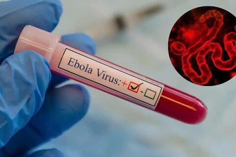 Virus Ebola có xu hướng lan rộng và biện pháp phòng ngừa của các nước