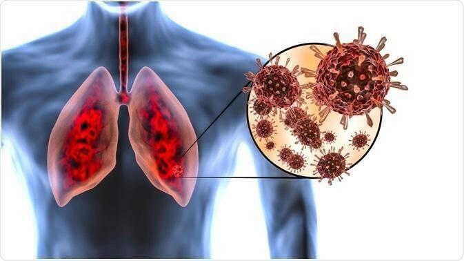 Những ảnh hưởng khôn lường mà bụi gây ra cho phổi cùng hệ hô hấp của con  người